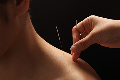 Acupuncture Image